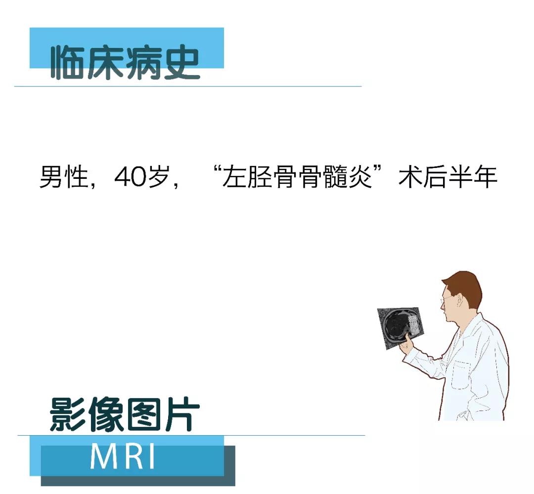 [Lonwin Images File] MRI case sharing (No. 20180209)