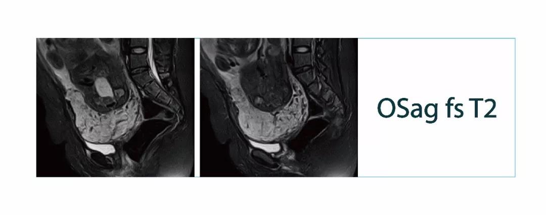 [Lonwin Images File] MRI case sharing (No. 20180302)