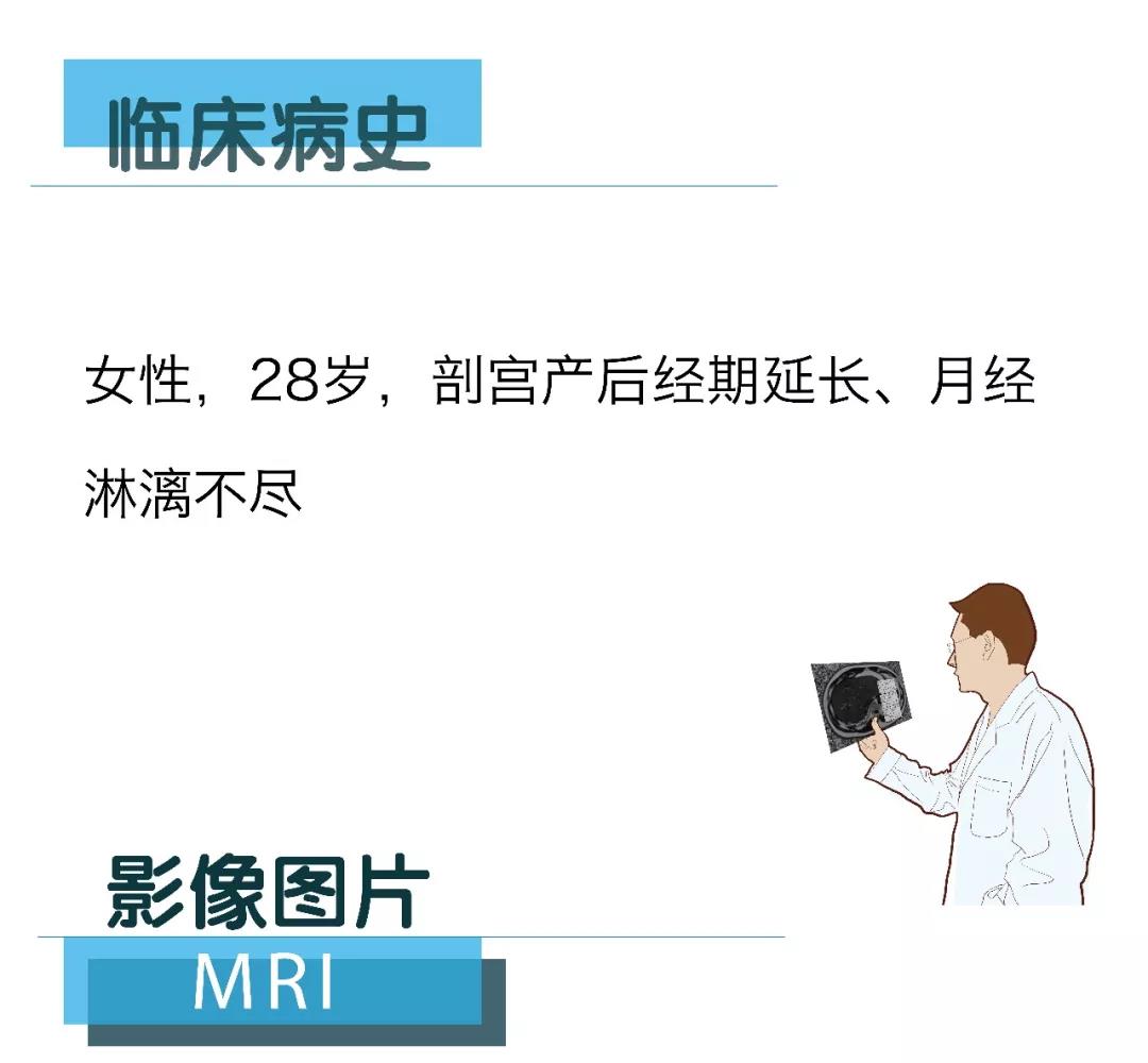 [Lonwin Images File] 20180309 Discussion of the results of MRI Cases