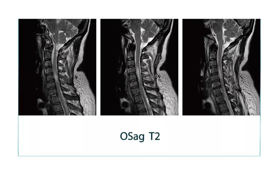 [Lonwin Images File] MRI case sharing (No. 20180330)